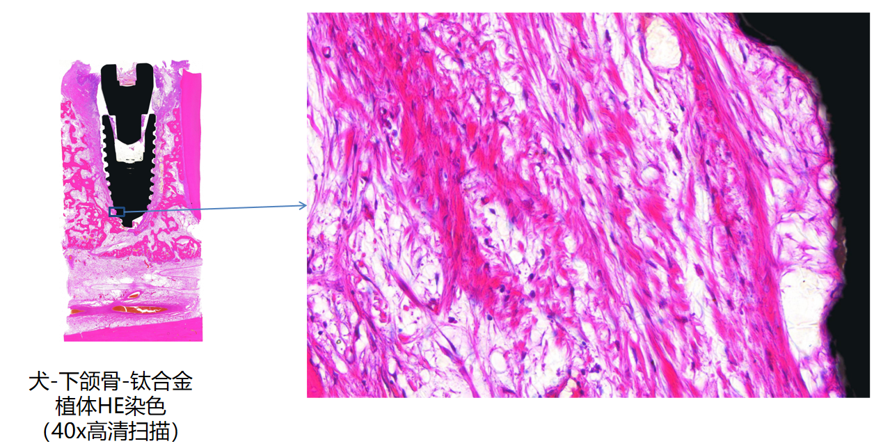 ABUIABAEGAAgjd2_vAYolsXqjgIw6Ak4gQU